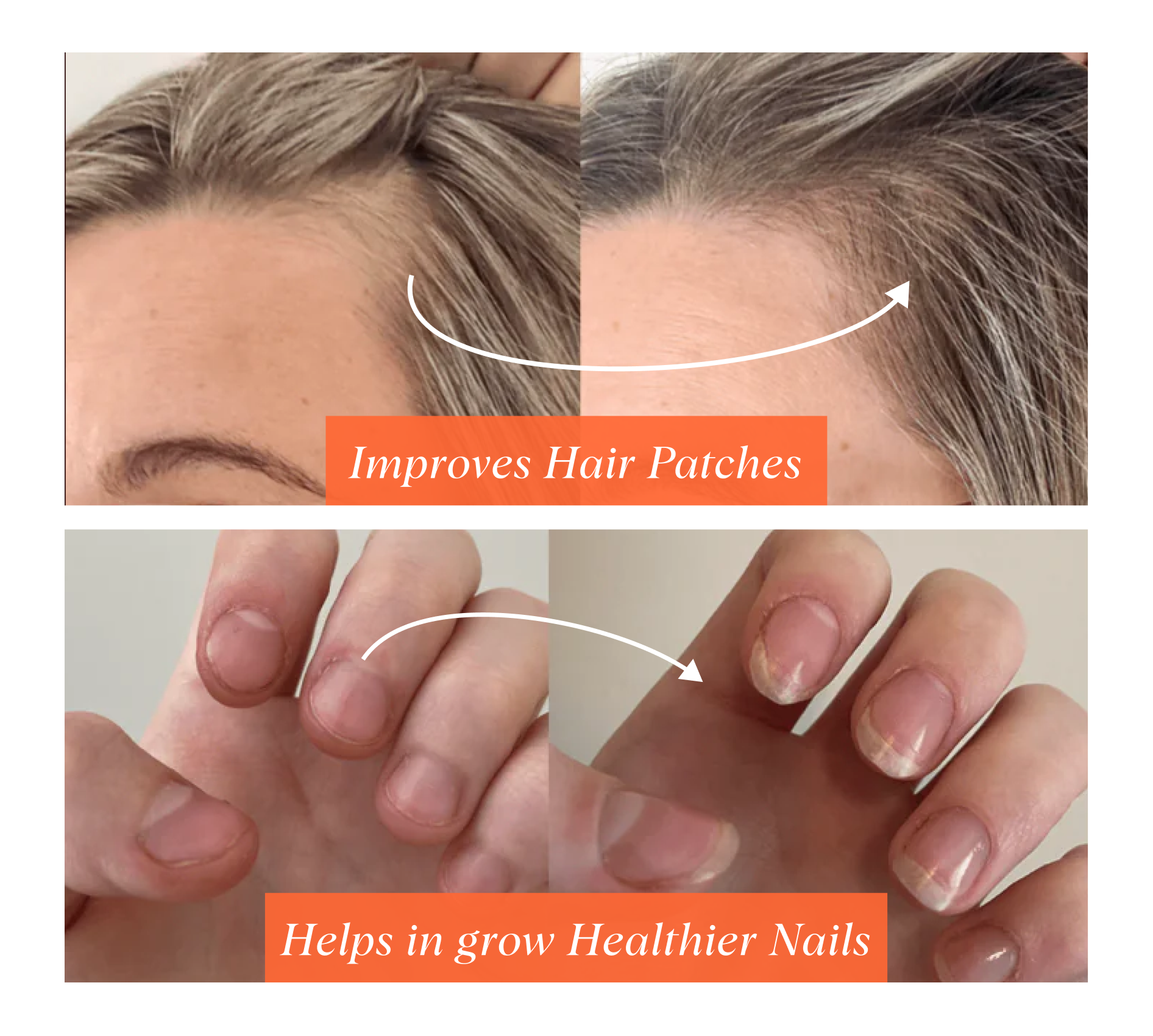 Improves hair patches,
helps in grow healthier nails