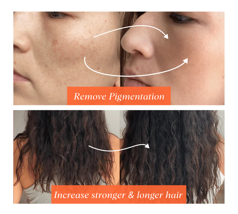 Before and after comparison of skin pigmentation and hair health.
Remove pigmentation,
Increase stronger & longer hair