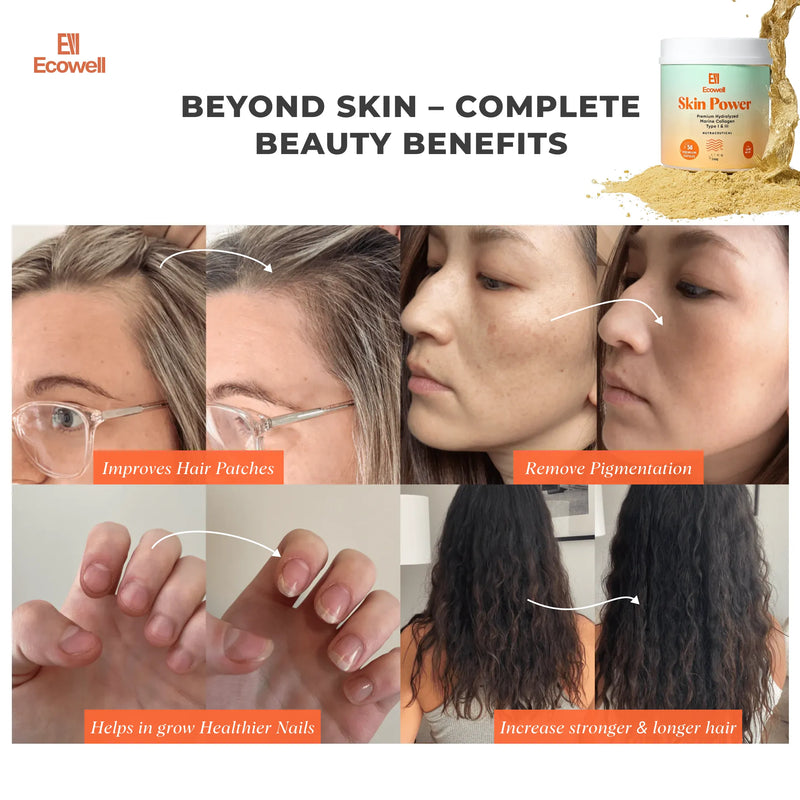 Advertisement for Ecowell Skin Power product with before-and-after images of skin and hair improvements.